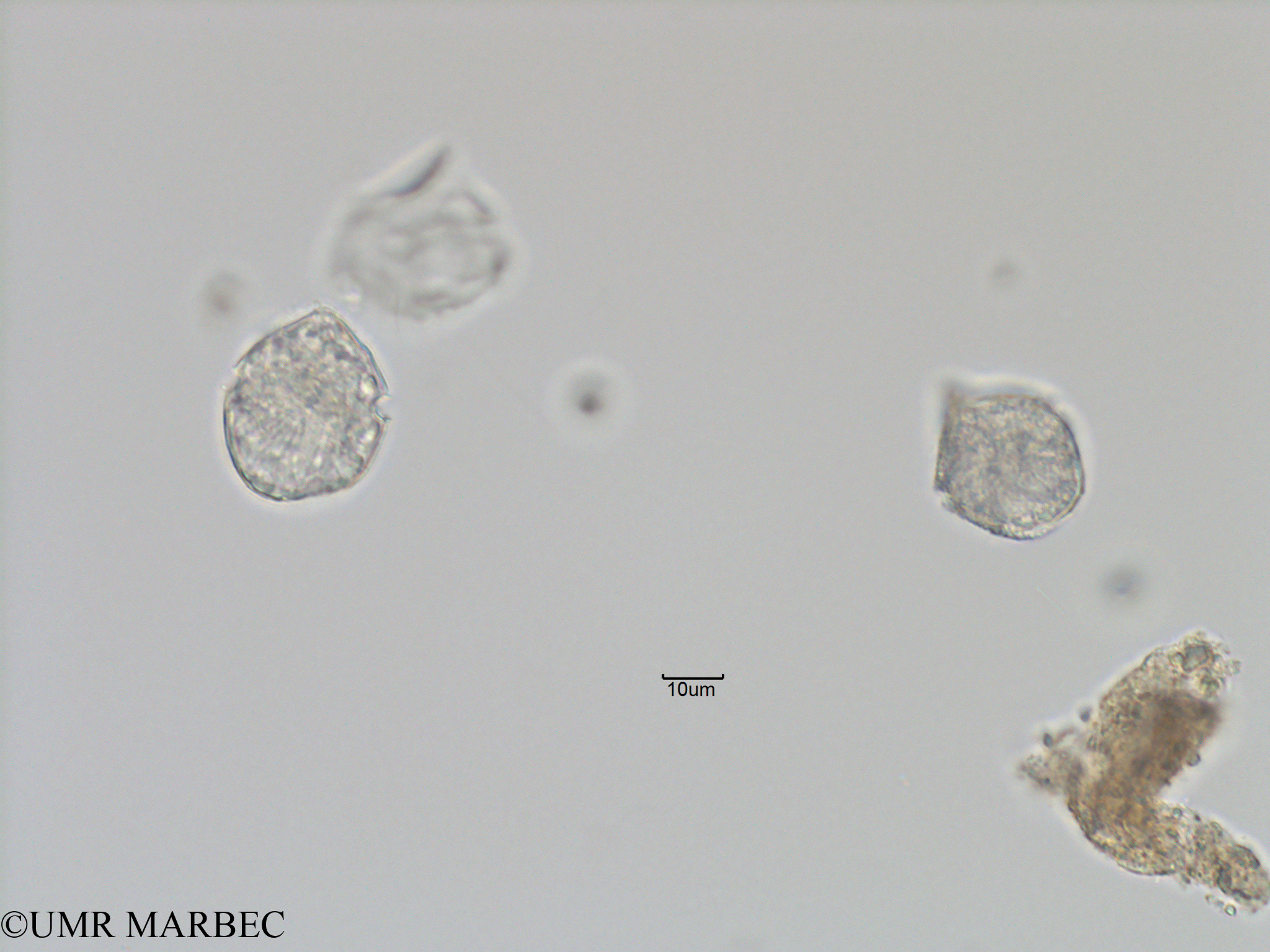 phyto/Bizerte/bizerte_bay/RISCO November 2015/Gonyaulax sp12 et Dino 43 (Baie_T5-C2-Protoceratium cf reticulatum et dino a identifier-17).tif(copy).jpg